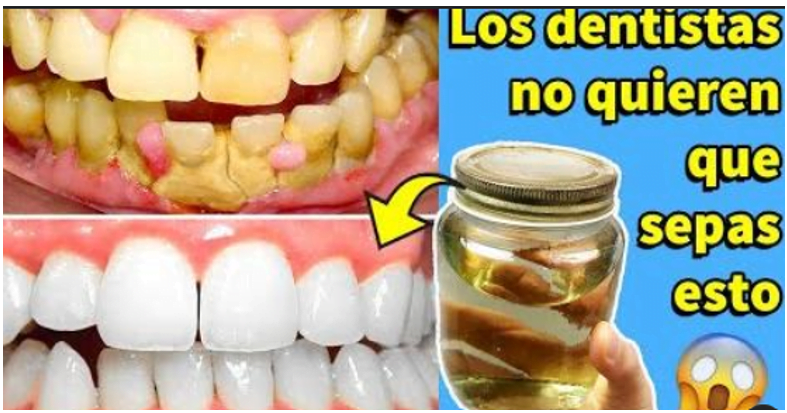 elimina-placa-dental